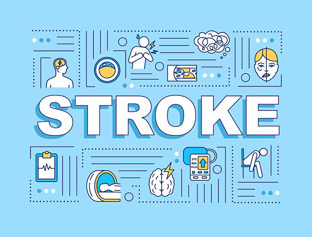 stroke คือ อาการ โรค สโตรก